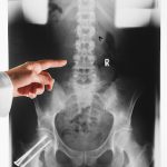 Supplements to Keep Your Bones Strong and Healthy