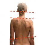 Why Your Spine Goes Out of Alignment?