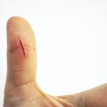 Can Your Body Heal Itself?