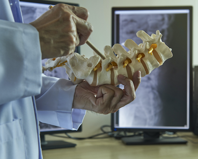 This is a picture of a neurosurgeon pointing to the spine. Chiropractic care after back surgery can provide pain relief, increased mobility, and better function.